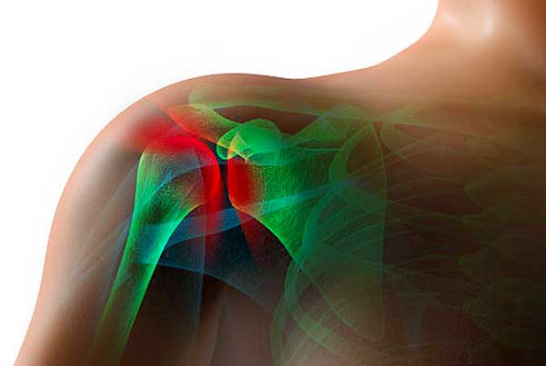 How-to-prevent-shoulder-injuries